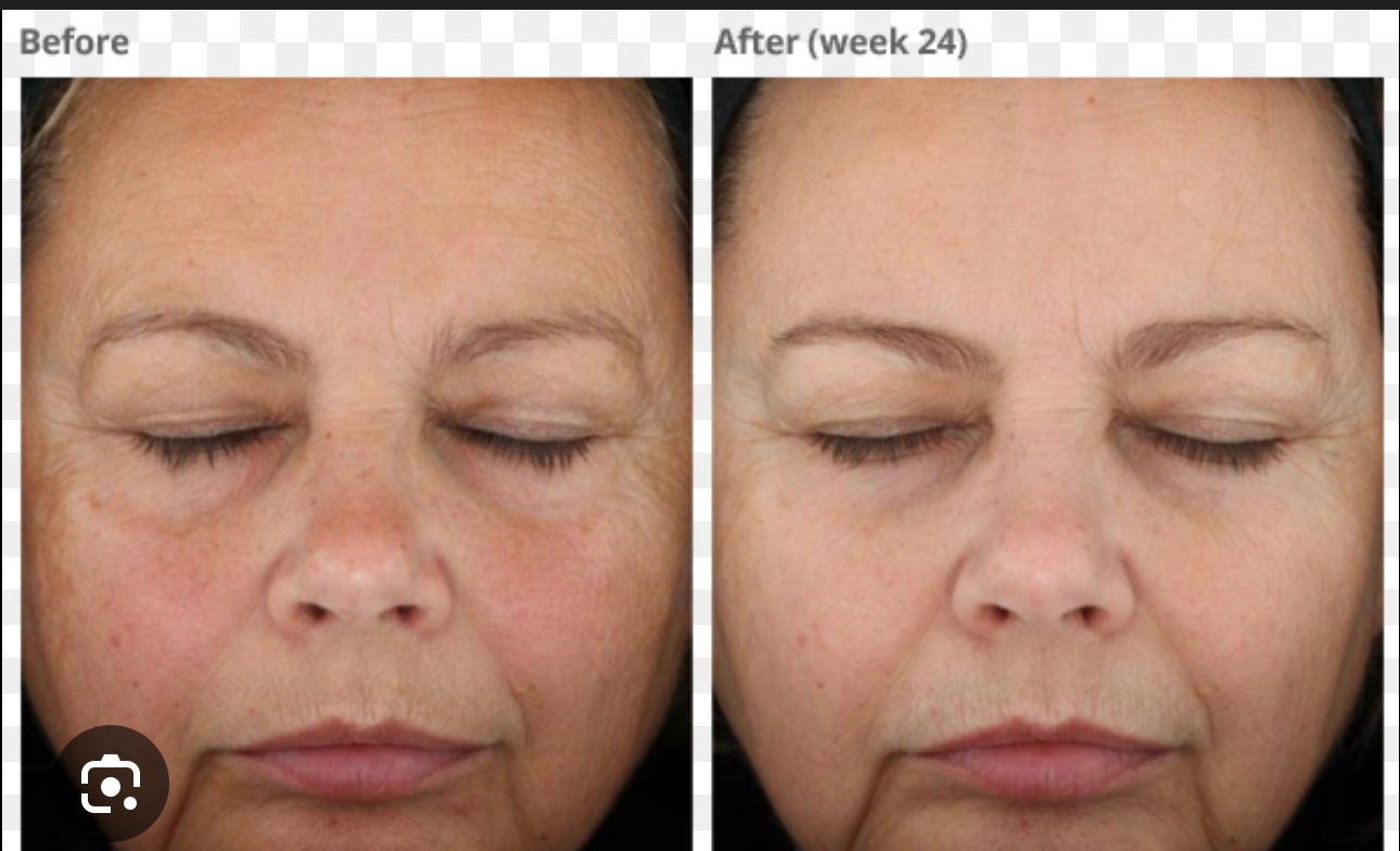 SkinMedica® TNS Advanced+ Serum – Advanced Growth Factor Anti-Aging Treatment