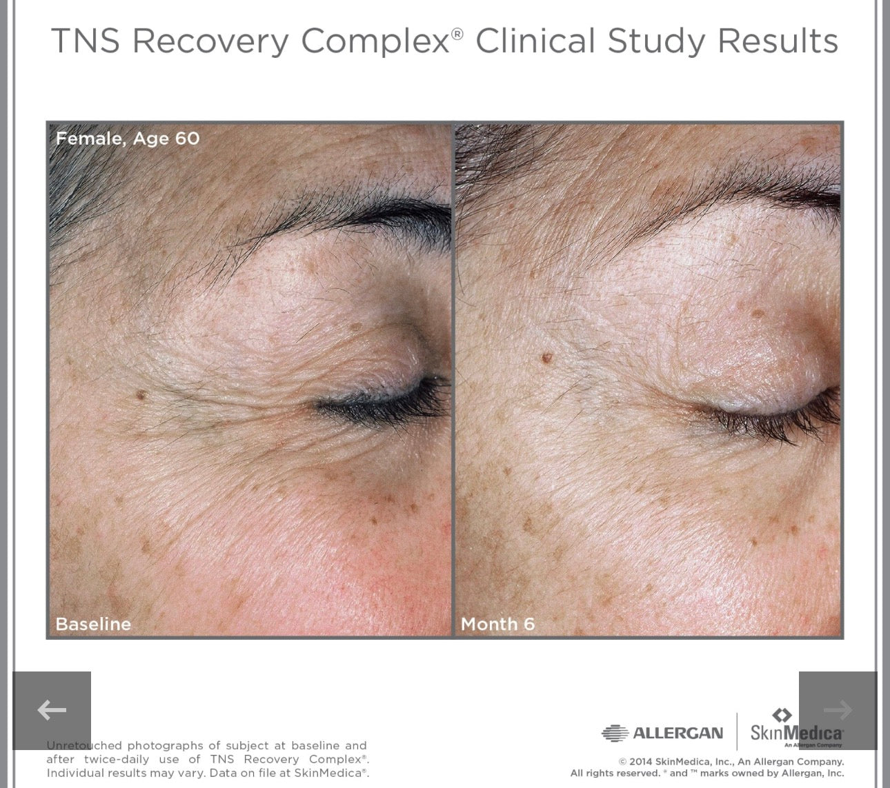 SkinMedica TNS Recovery Complex 1oz/30ml Anti-aging Exosomes SALE AUTHENTIC