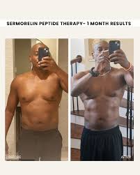 Sermorelin 9mg Pharm