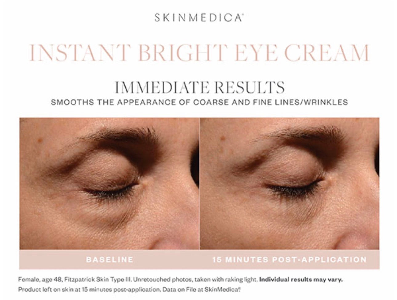 Skinmedica Instant Bright Eye Cream 1oz