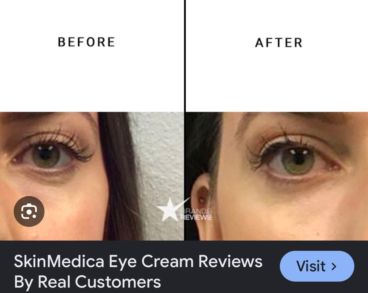 Skinmedica Instant Bright Eye Cream 0.5 fl oz. Brightening Dark Circles puffiness anti-aging Undereye Bags hollowing