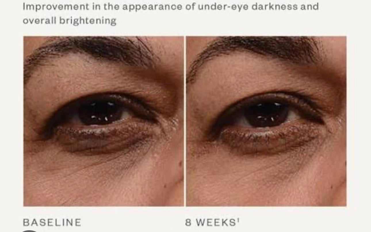 Skinmedica Instant Bright Eye Cream 1oz