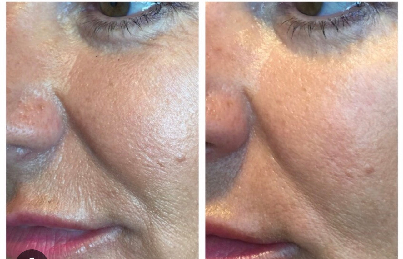 Skinmedica Rejuvenative Moisturizer 2oz/ 56.7g  Moisturizer Antioxidants Vitamin A, C & E Rich Cream Hydrates stressed, dry skin