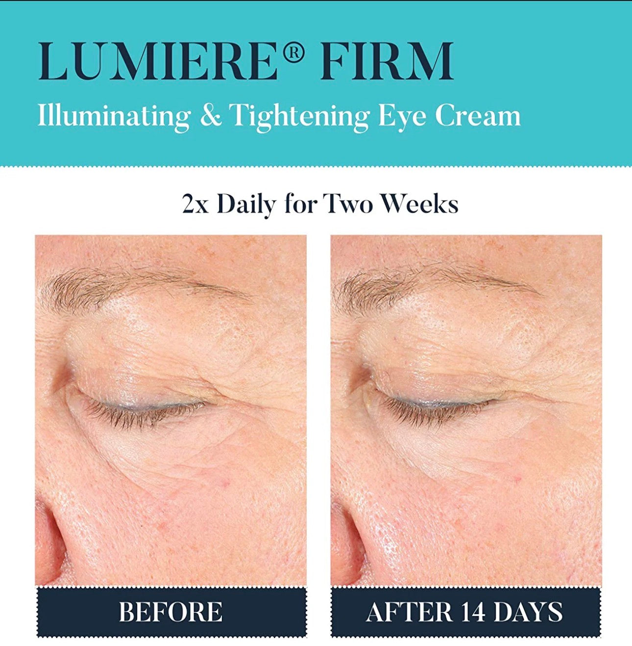 Neocutis Lumière Firm Eye Cream – Advanced Peptide Eye Treatment for Dark Circles & Puffiness