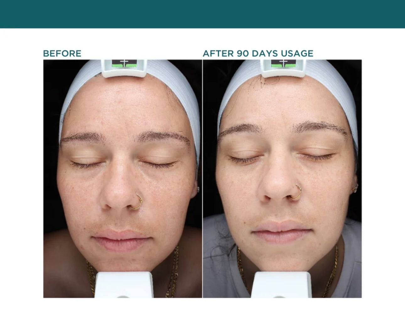 VI Derm Pigment Correcting System