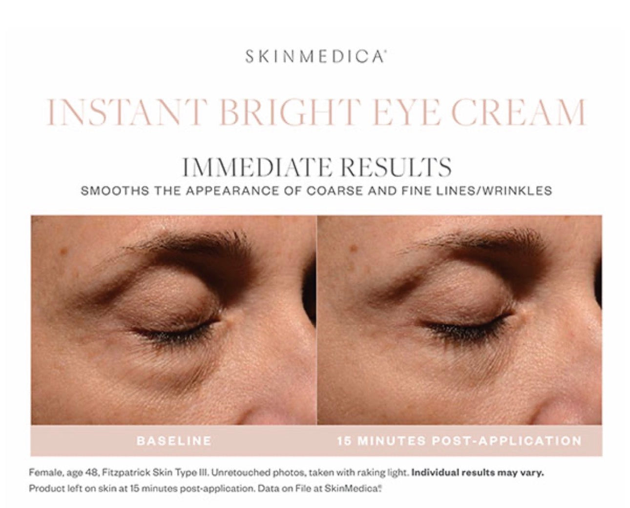 Skinmedica Instant Bright Eye Cream 1oz