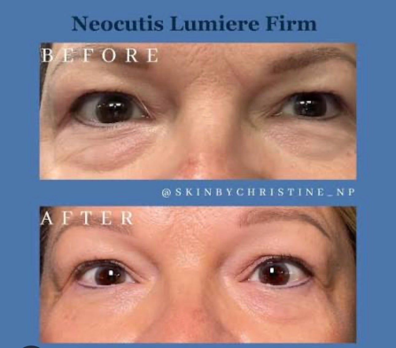 Neocutis Lumière Firm Eye Cream – Advanced Peptide Eye Treatment for Dark Circles & Puffiness