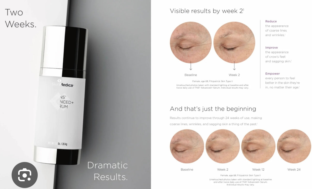 SkinMedica® TNS Advanced+ Serum – Advanced Growth Factor Anti-Aging Treatment