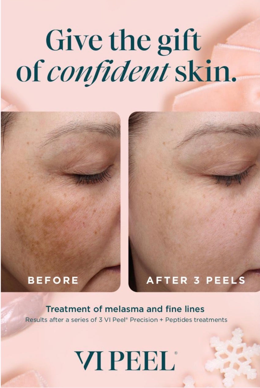 VI Peel Precision Plus Peptides