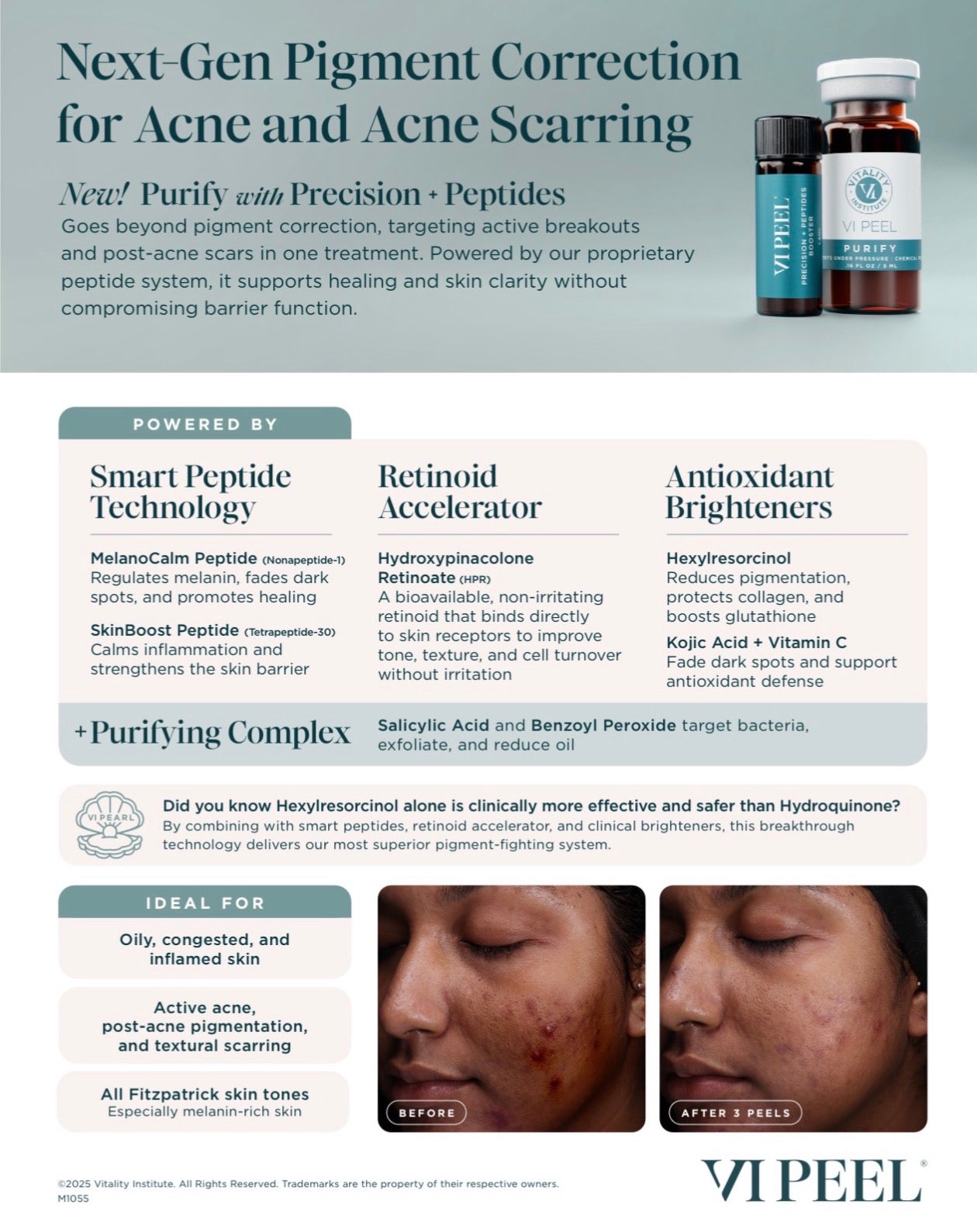 VI Peel Precision Plus Peptides
