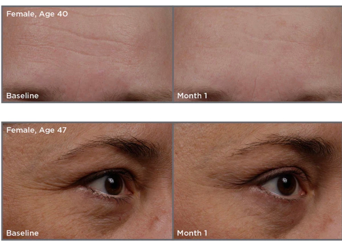 SkinMedica TNS Recovery Complex 1oz/30ml Anti-aging Exosomes SALE AUTHENTIC anti-aging wrinkles tightening lifting REAL growth factor enhanced. 1st on market. Human fibroblast conditioned media. Collagen boosting. NEW in Box, sealed!