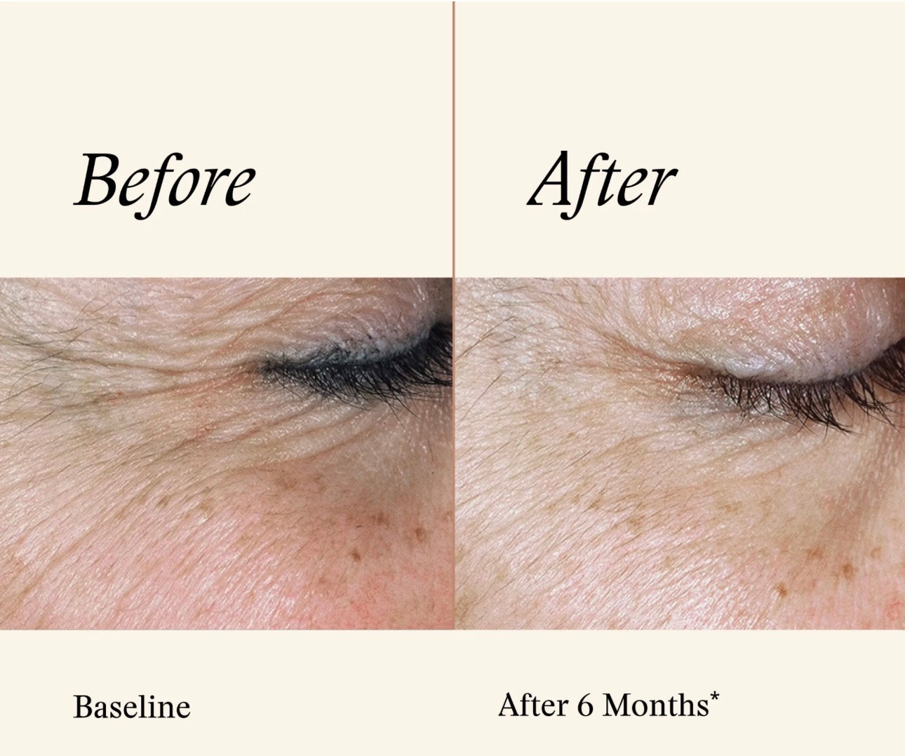 SkinMedica TNS Recovery Complex 1oz/30ml Anti-aging Exosomes SALE AUTHENTIC anti-aging wrinkles tightening lifting REAL growth factor enhanced. 1st on market. Human fibroblast conditioned media. Collagen boosting. NEW in Box, sealed!