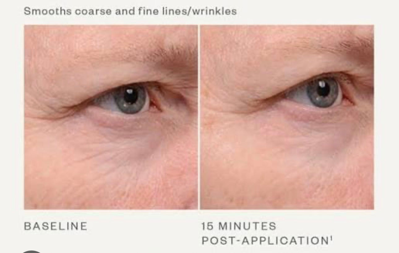 Skinmedica Instant Bright Eye Cream 1oz