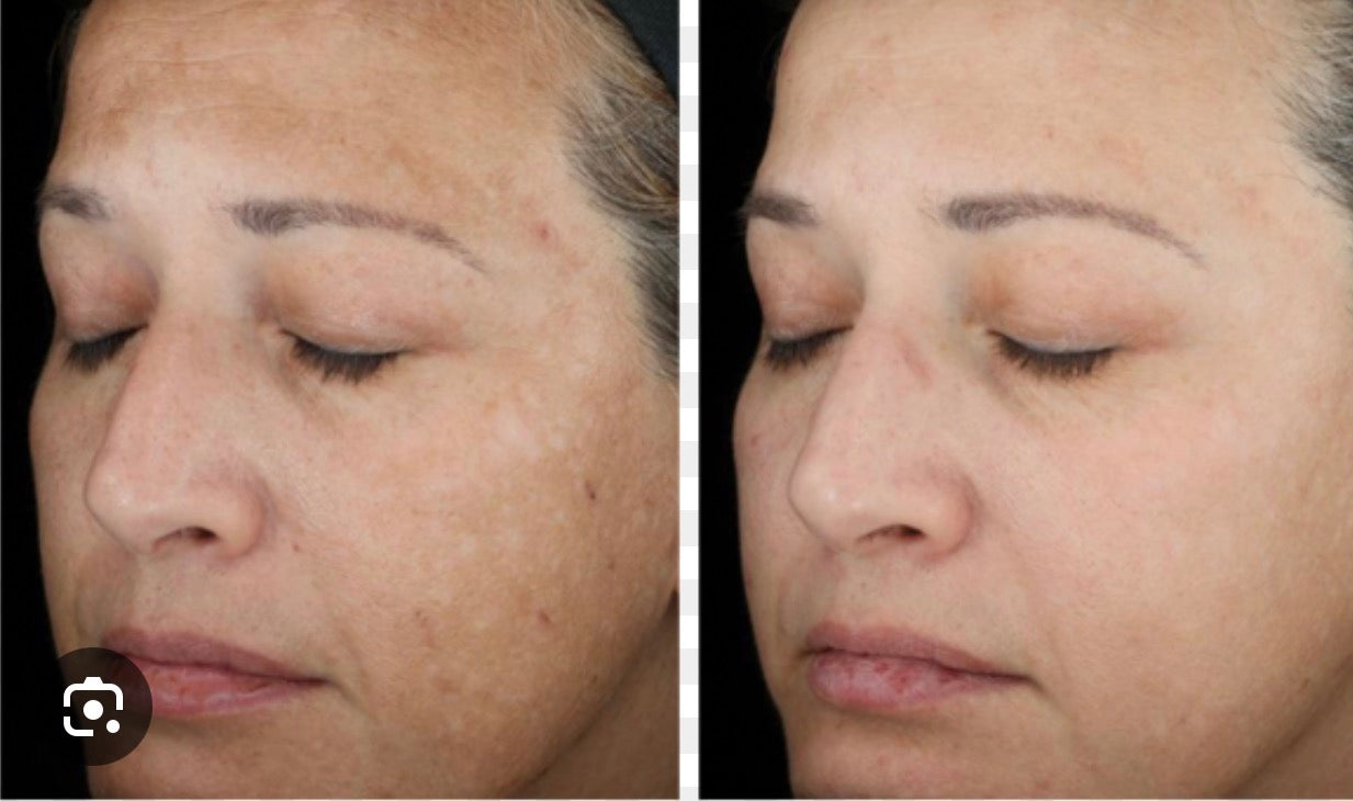 SkinMedica TNS Recovery Complex 1oz/30ml Anti-aging Exosomes SALE AUTHENTIC anti-aging wrinkles tightening lifting REAL growth factor enhanced. 1st on market. Human fibroblast conditioned media. Collagen boosting. NEW in Box, sealed!