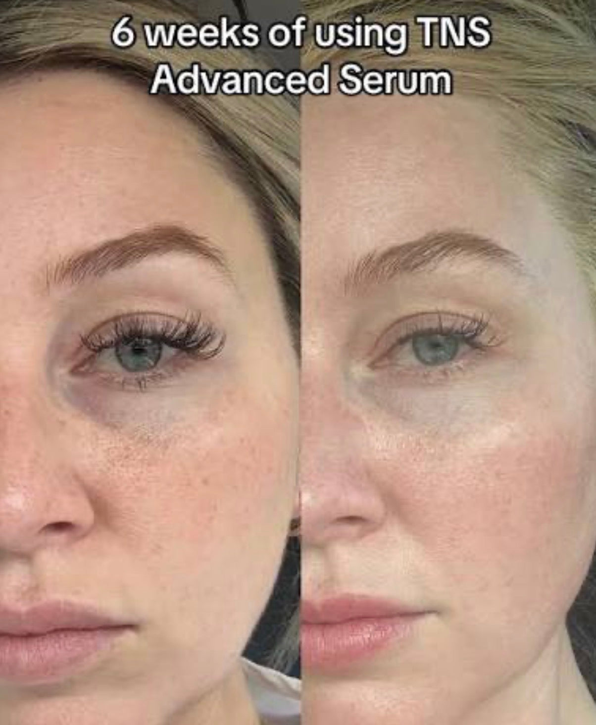 SkinMedica® TNS Advanced+ Serum – Advanced Growth Factor Anti-Aging Treatment