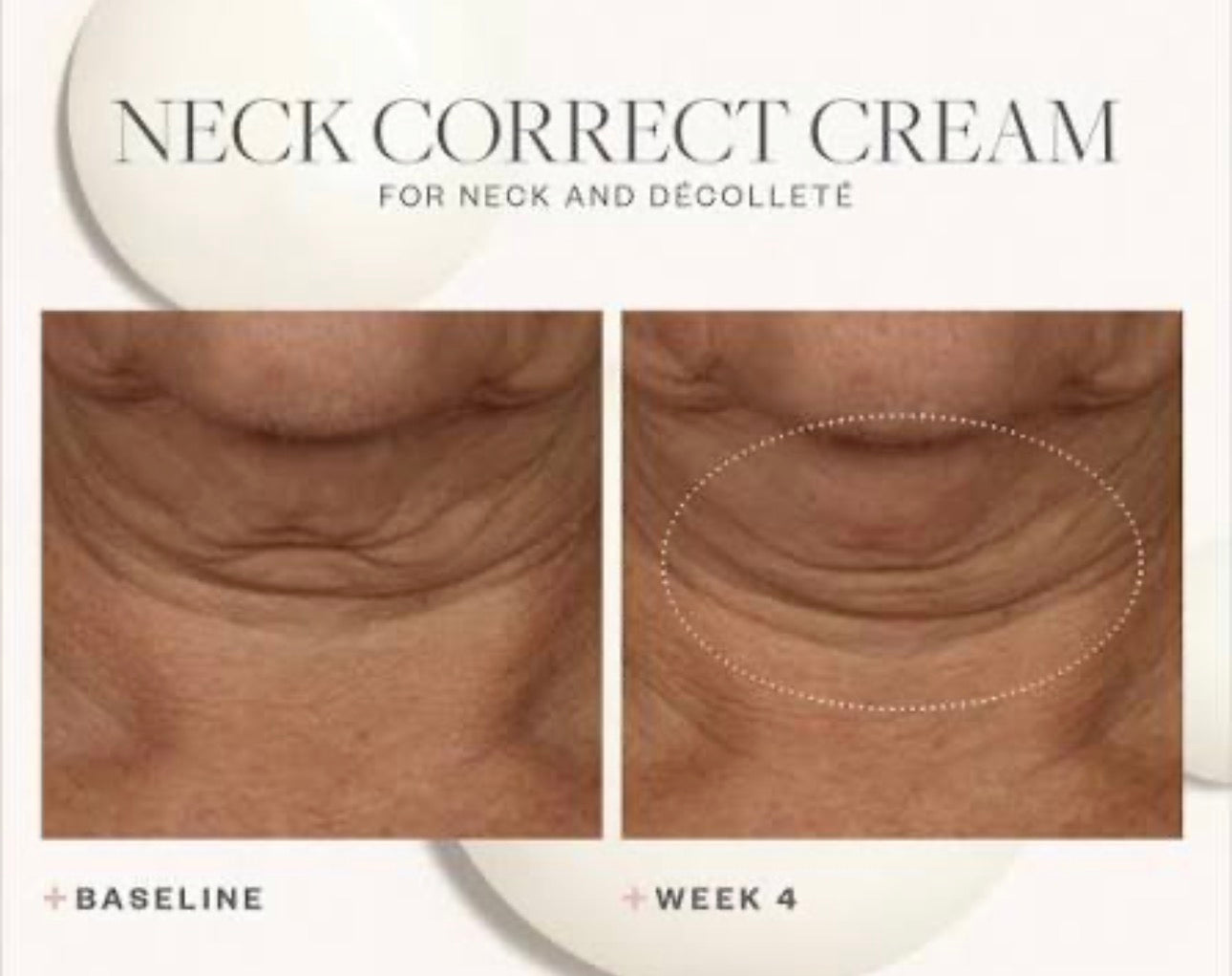Skinmedica Neck Correct Cream 2oz Neck/ Chest/ Décolleté Tightening Lifting Anti-aging Cream 8 week Results! Chicken Neck